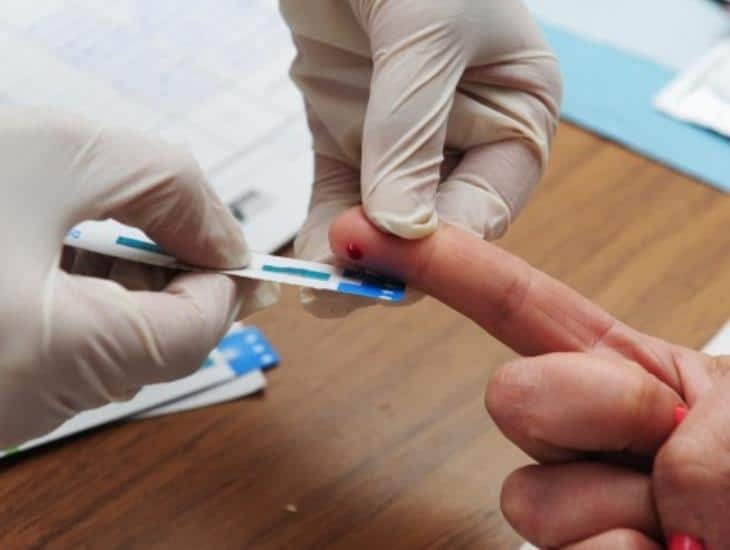 En 36 años, 18 mil casos de sida en Veracruz