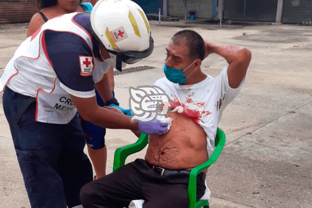 Apuñalan a hombre frente al mercado Terraplén de Coatzcoalcos