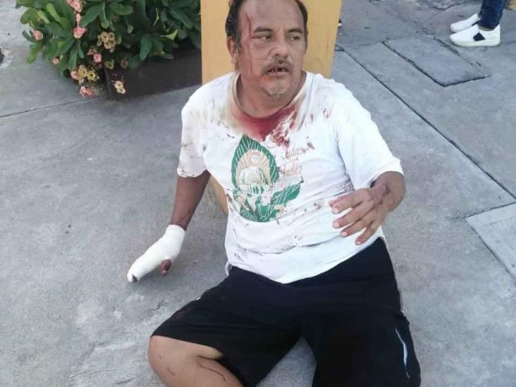 Con lujo de violencia asaltan a hombre con machete en mano; resulta herido