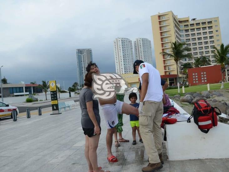 Medusa le pica a turista en playas de  Veracruz