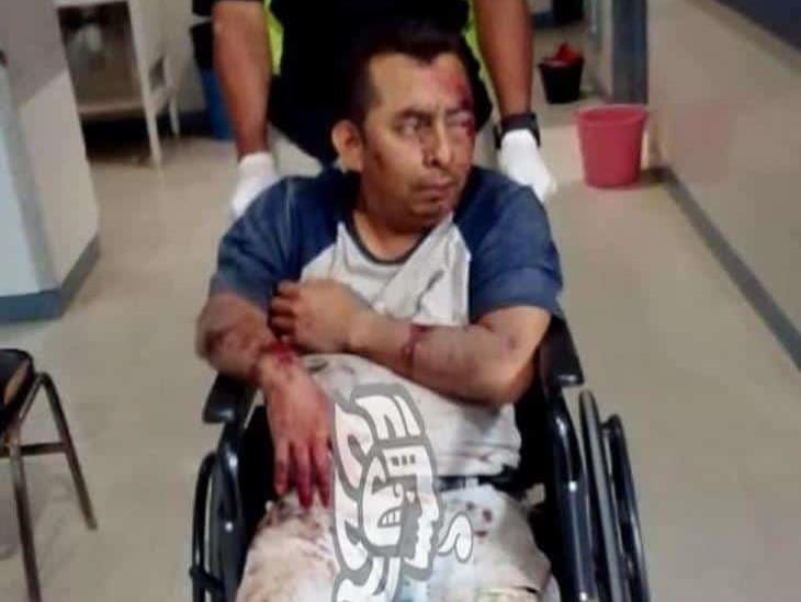Empleado sayuleño queda fracturado al derrapar en su motocicleta