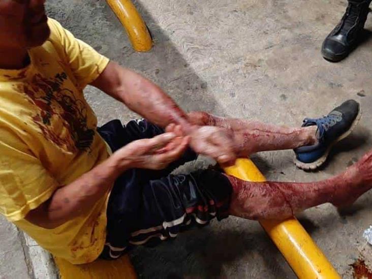 Tras ser golpeado y amarrado, hombre en estado de ebriedad solicita ayuda