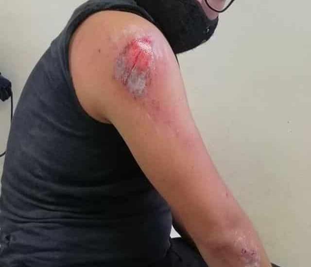 En Veracruz, taxista impacta a motociclista