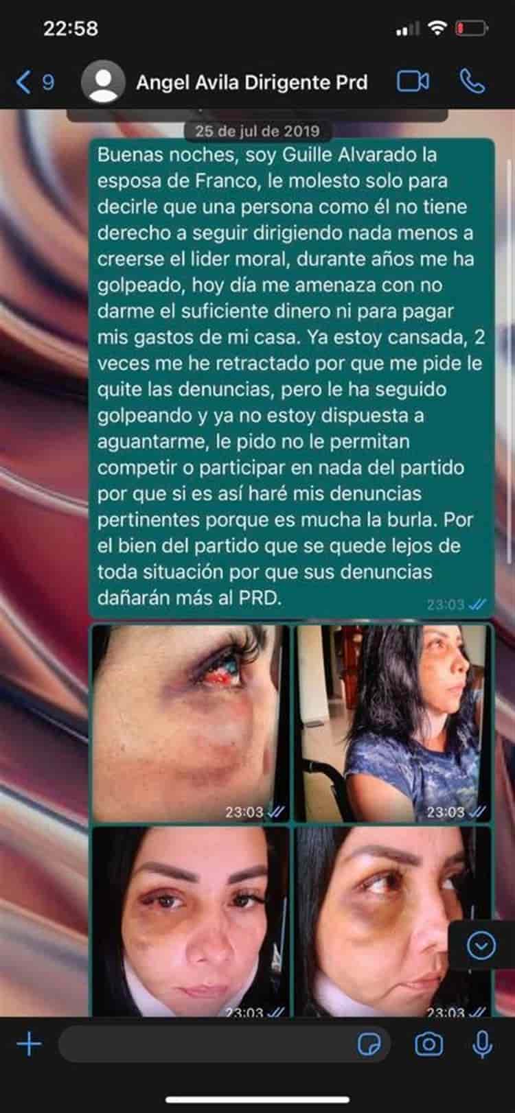 PRD me acosa para proteger a golpeador, temo por mi vida: ex esposa de Franco