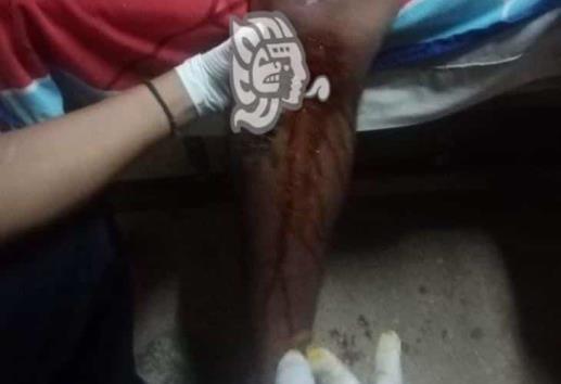 Joven se dispara por accidente durante borrachera