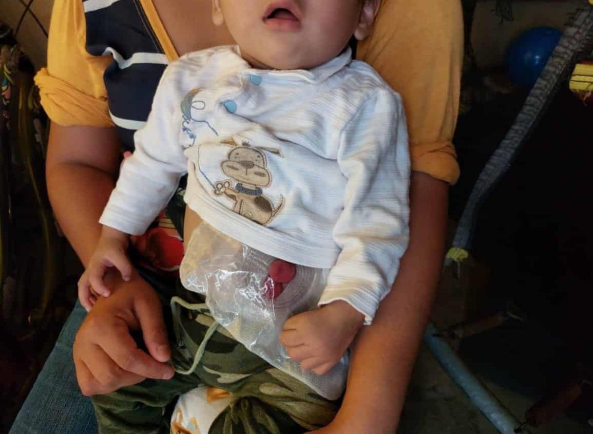 Madre de pequeño con síndrome de Townes Brocks buscará ayuda en CDMX