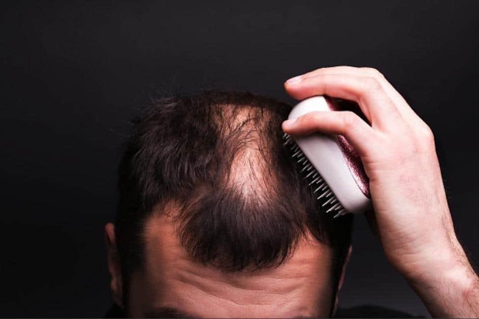 Aprueba EU píldora contra la alopecia