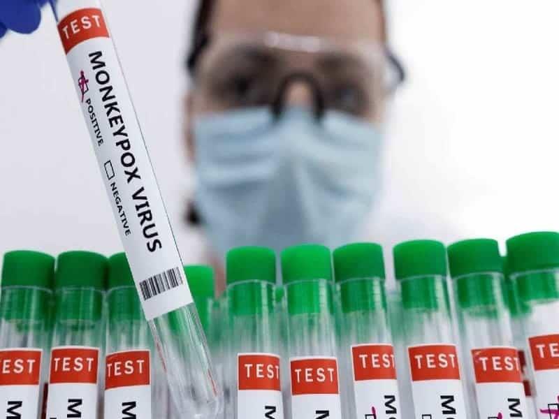 Revela OMS primer perfil de los afectados con la viruela del mono
