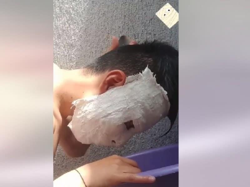 Joven se queda pegado a mascara de yeso y se hace viral