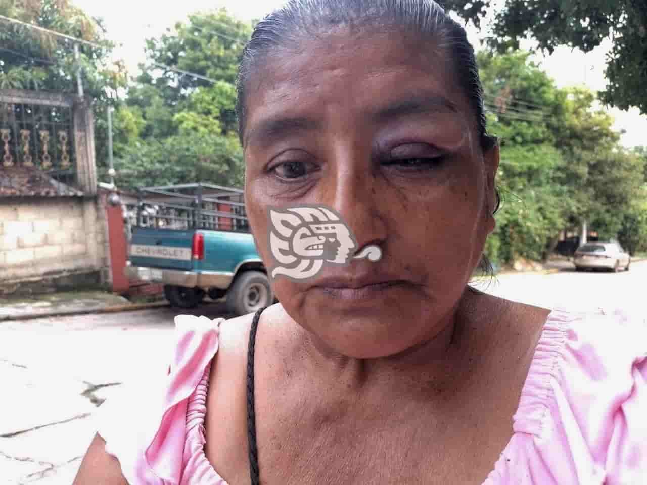 Fiscalía Especializada niega atención a sayuleña golpeada al defender a su hija