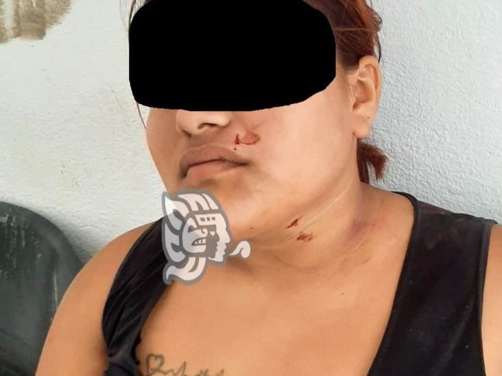 En Papantla, sujeto intenta matar a su exesposa a cuchilladas