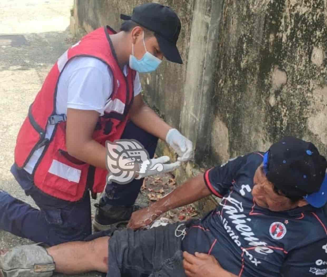 Ebrio sujeto sufrió atropellamiento en Cosoleacaque