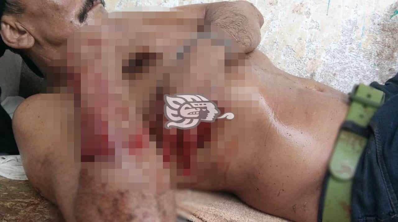 Ebrio sujeto lo machetea sin razón en una localidad de Misantla