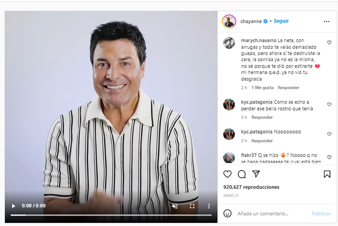 Chayanne preocupa a sus fans; aparece con un rostro diferente