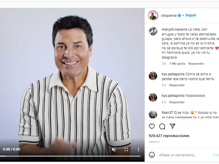 Chayanne preocupa a sus fans; aparece con un rostro diferente