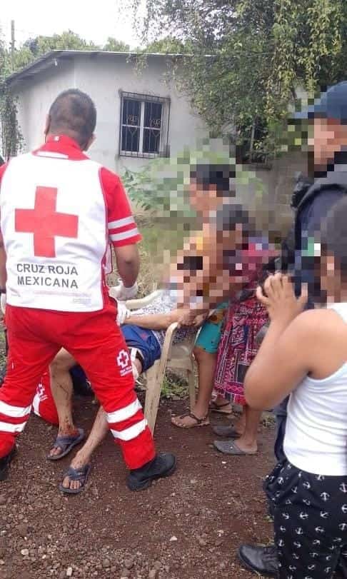 Hieren a hombre con arma de fuego en El Salto de Eyipantla