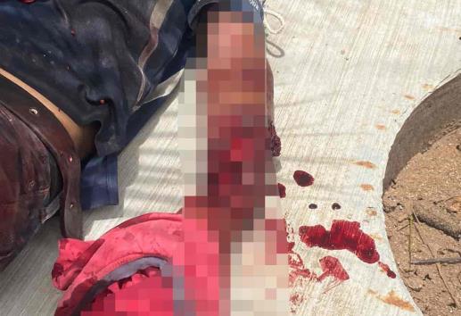 Le amputan el brazo luego de ser atacado por unos perros
