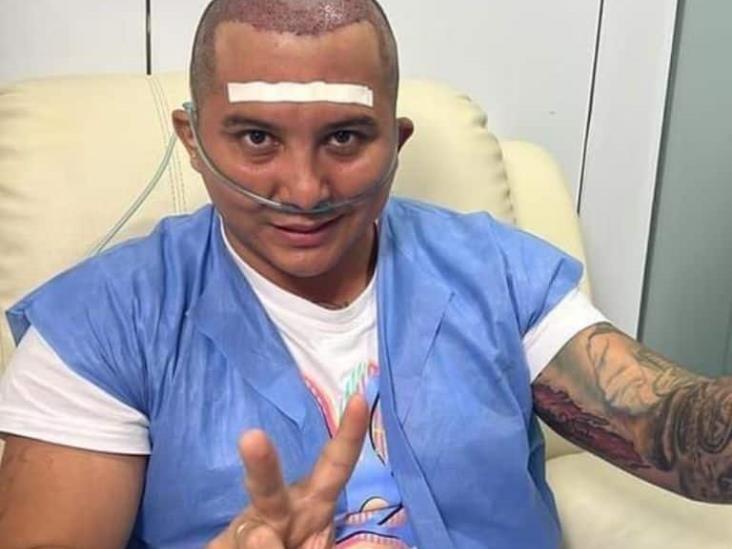 ¡Se metió cuchillo! Edwin Luna se somete a procedimiento capilar