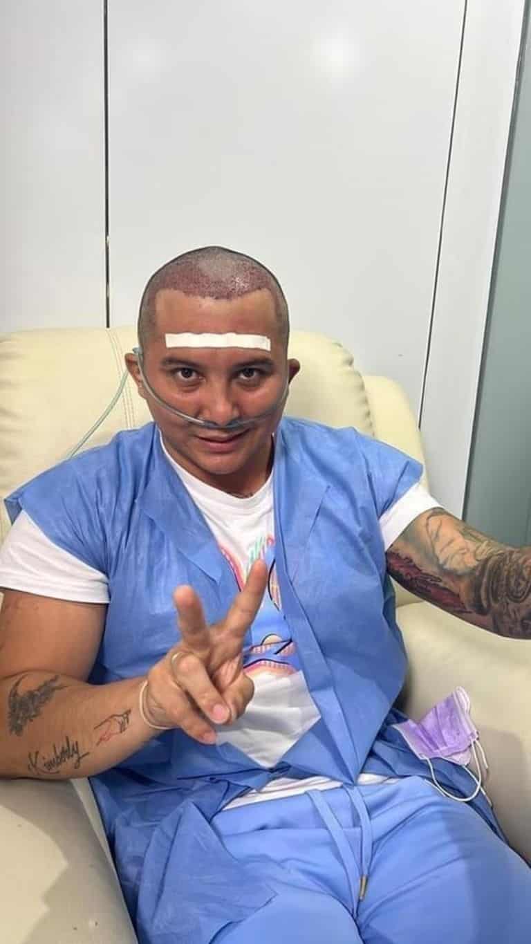 ¡Se metió cuchillo! Edwin Luna se somete a procedimiento capilar