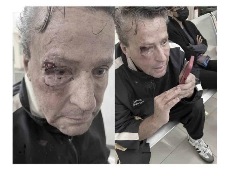 Hospitalizan a Alfredo Adame; tiene fuertes lesiones en el ojo (+Video)