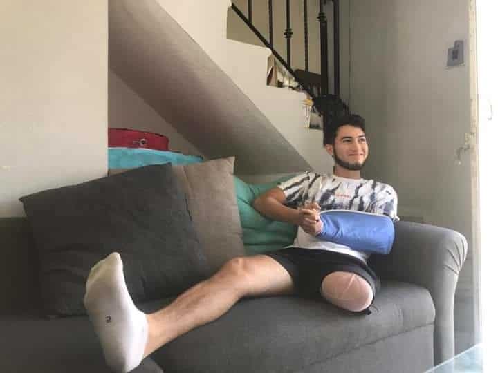 Hugo quiere una prótesis para su pierna; la perdió en un accidente de moto