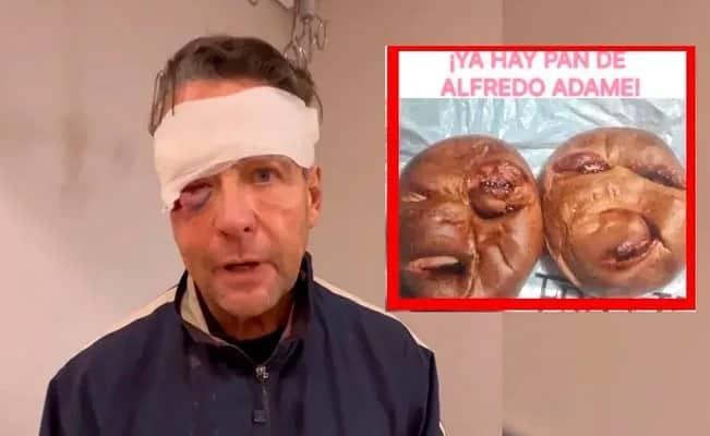 ‘Se pasan banda’, dice Adame ante pan inspirado en su rostro golpeado