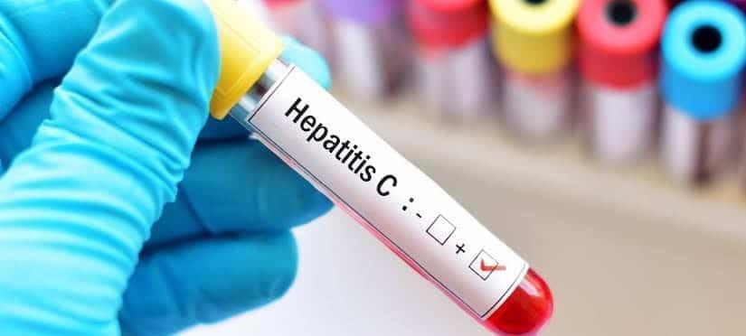 ¿Sabes si tienes Hepatitis C? Realizarán pruebas gratis en Hospital de Veracruz