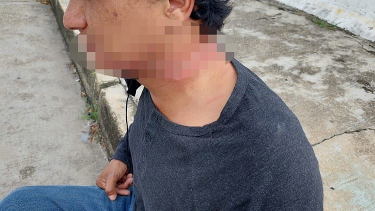 Motociclista, a punto de degollarse en Minatitlán