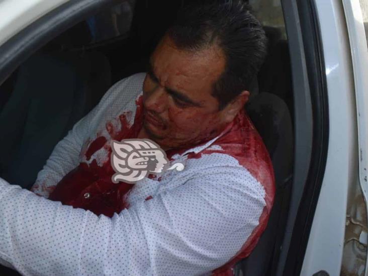 Muere regidor de Texistepec tras ataque de sicarios en Acayucan