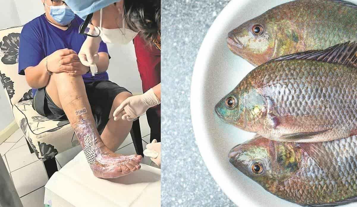 Universidad Autónoma de Querétaro usa piel de tilapia para curar pie diabético