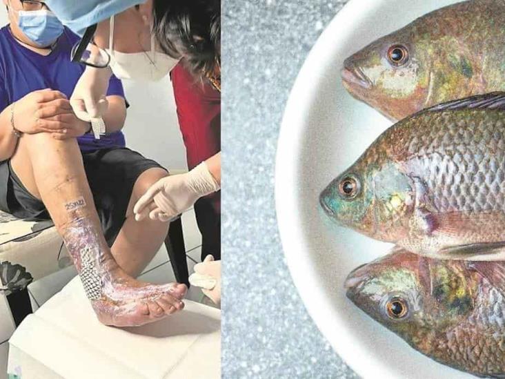 Universidad Autónoma de Querétaro usa piel de tilapia para curar pie diabético