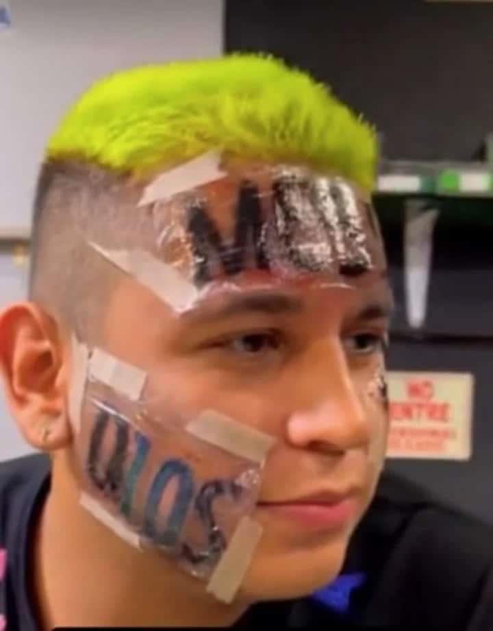 Influencer que se tatuó ‘Messi’ en la cara se arrepiente