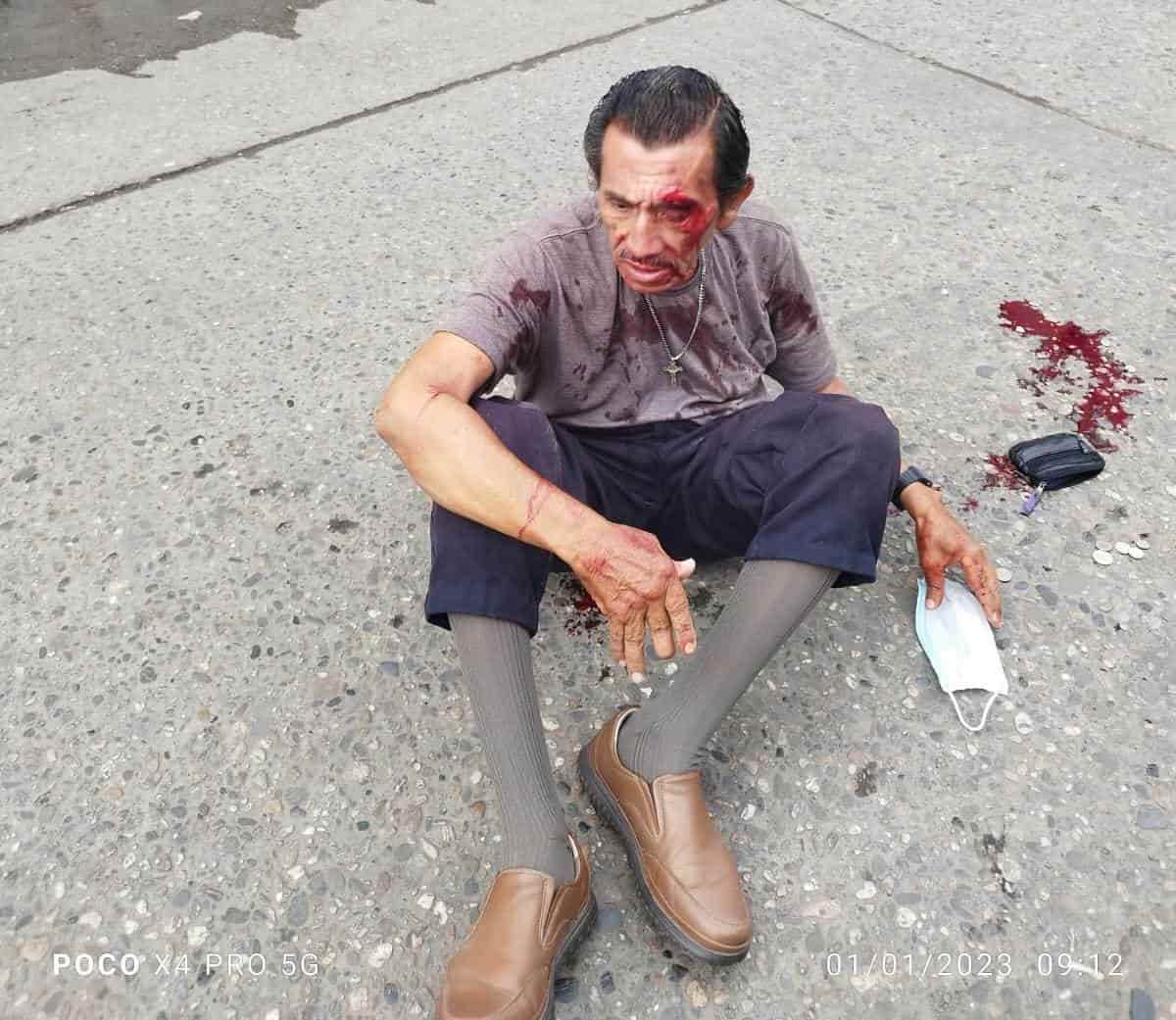 Sexagenario herido de la cabeza tras desmayo en Cosamaloapan