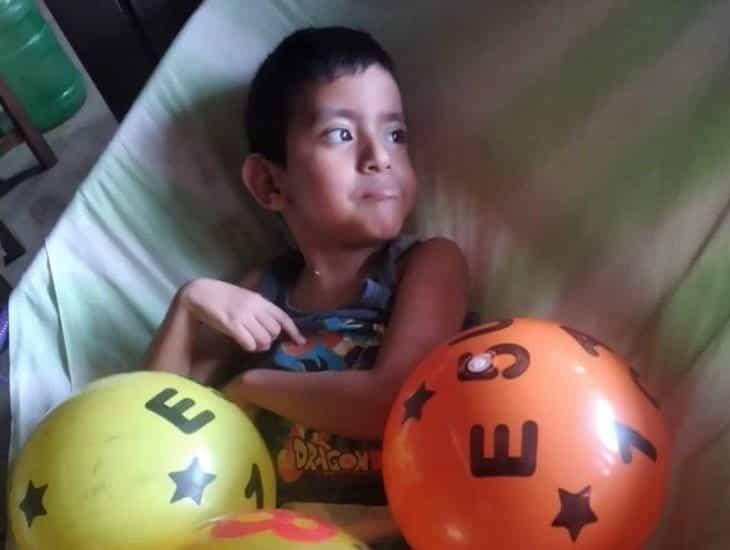 Rifarán una moto, con la esperanza que el pequeño Jonathan pueda caminar