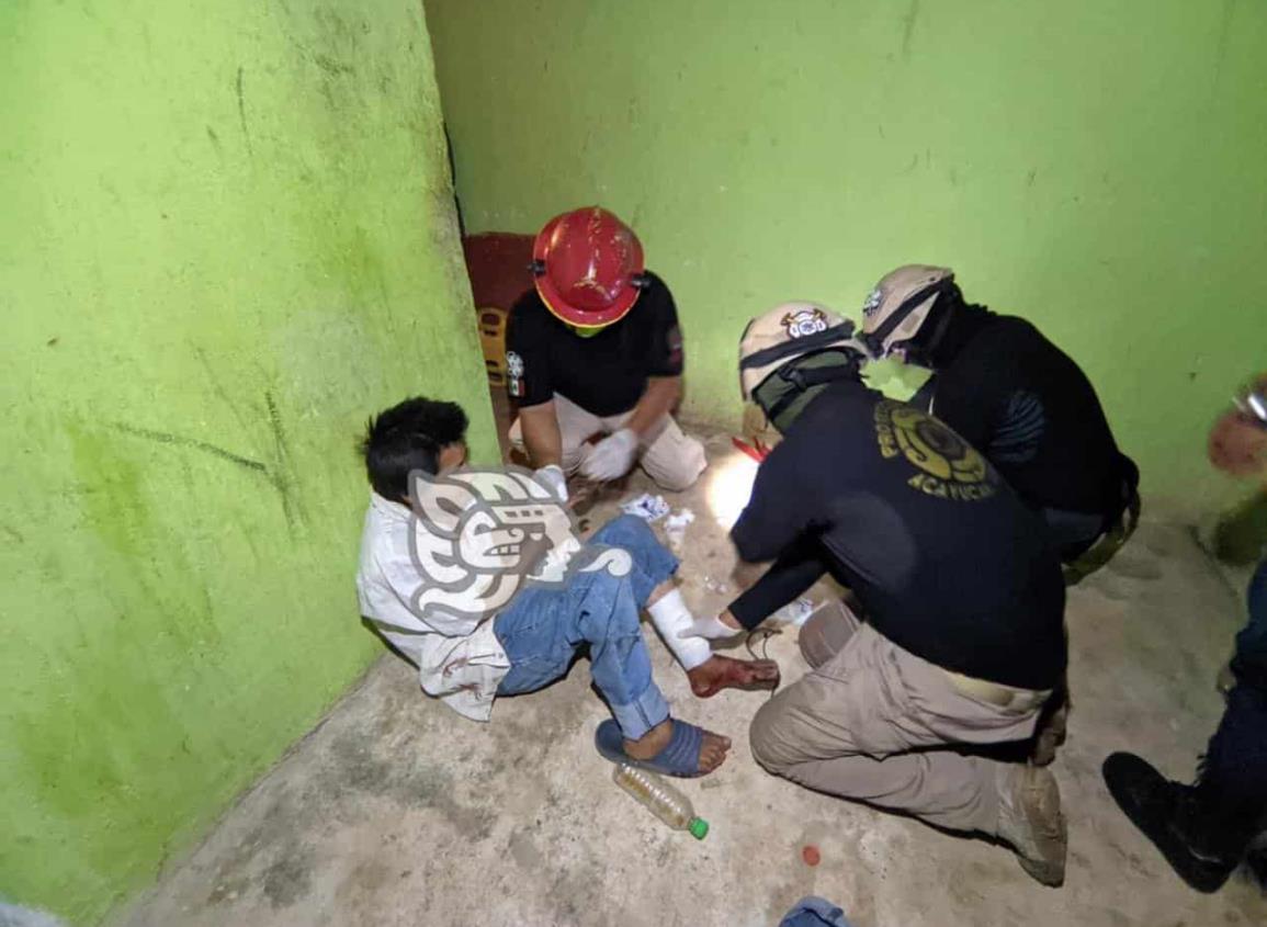 ¡Por rata! le habrían mochado un dedo en Acayucan
