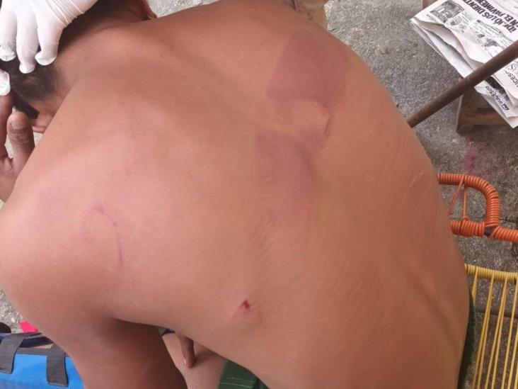 Tras defender a su pareja, lo agreden a planazos en Acayucan