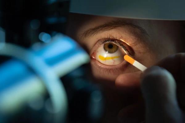 Invita UMAE del IMSS en Veracruz Norte a acudir con oftalmólogo para una oportuna detección de glaucoma
