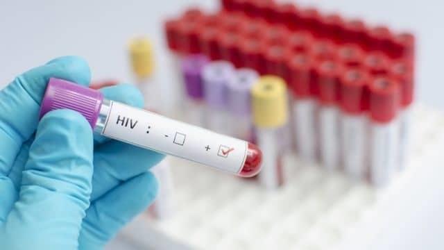 ¿Será posible? Células madre consiguen posible cura de VIH a mujer