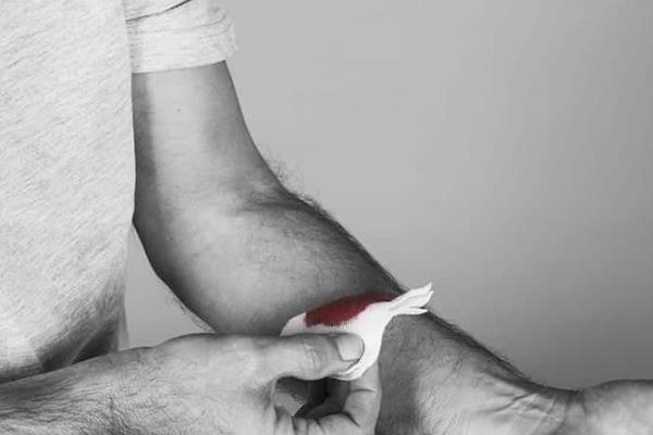 IMSS Veracruz Norte advierte sobre síntomas de hemofilia
