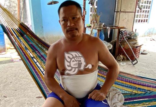 Ladrones lo hieren en Minatitlán; no puede mantener a su familia (+Video)