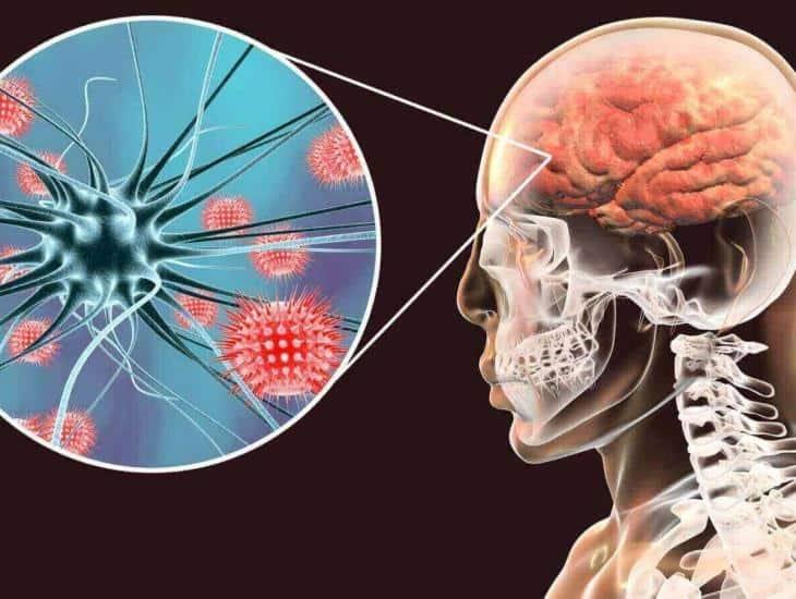 Clínicas donde se originó casos de meningitis fueron clausuradas, afirmó AMLO