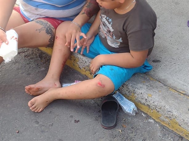 Motociclista atropella a niño en colonia de Veracruz
