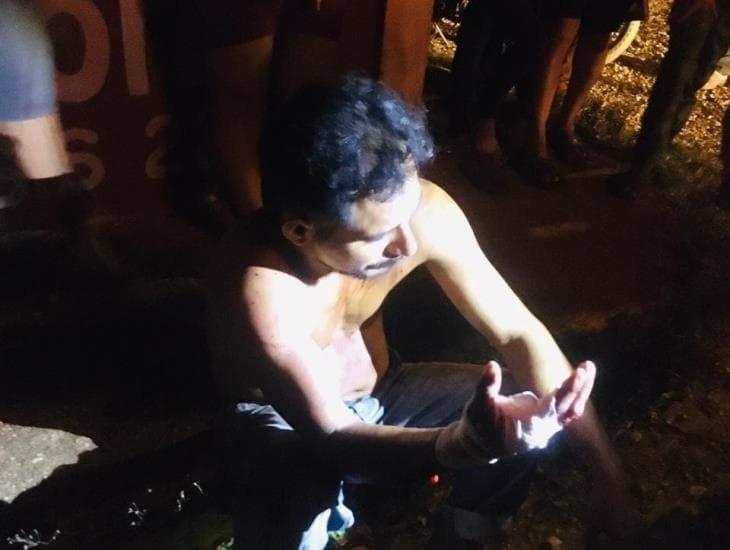 Atacan a campesino de Acayucan con machete; casi le cortan la mano