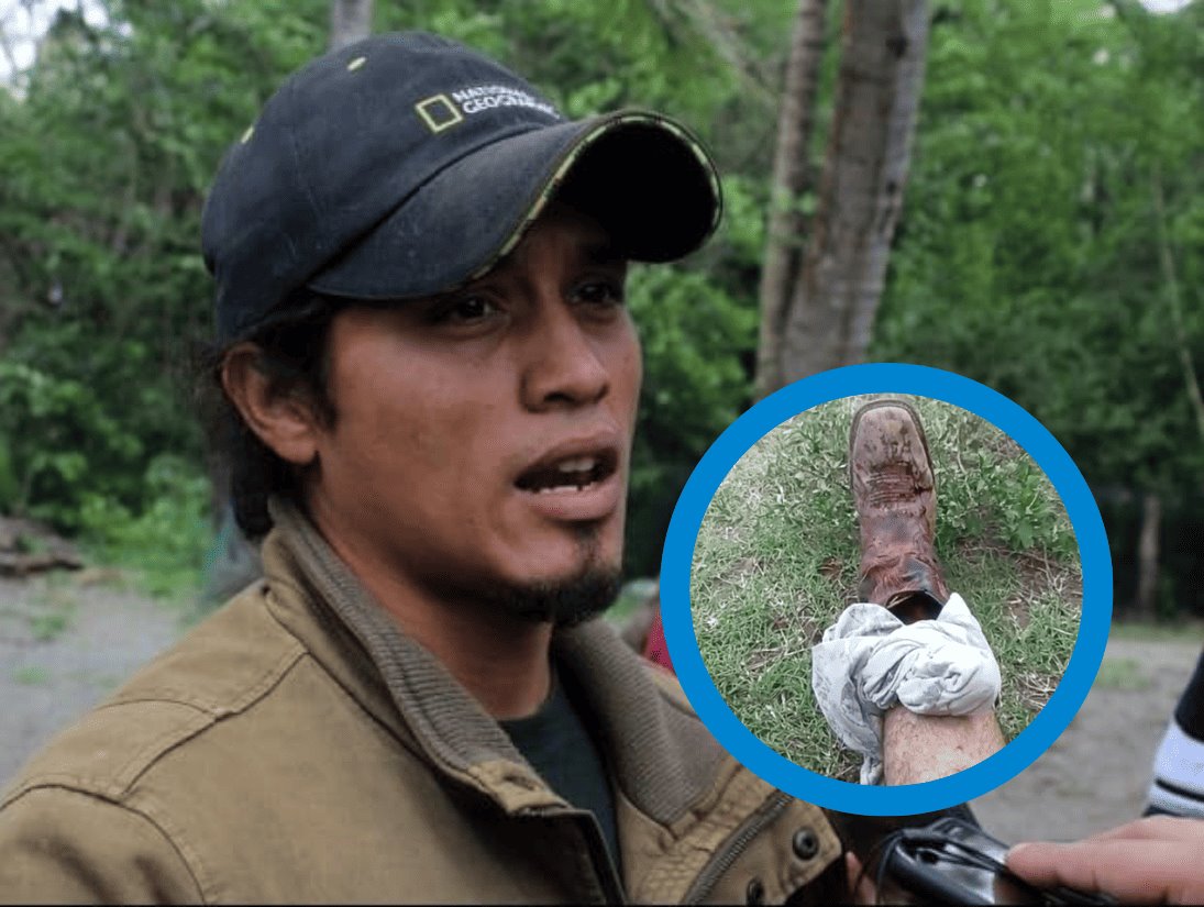 Jabalí ataca a presidente de Earth Mission; transmite en vivo llamado de auxilio