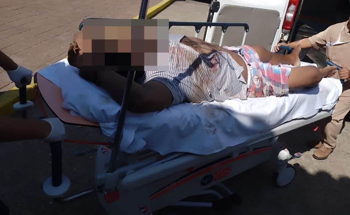 Atacan a balazos a comerciante en Ciudad Isla 