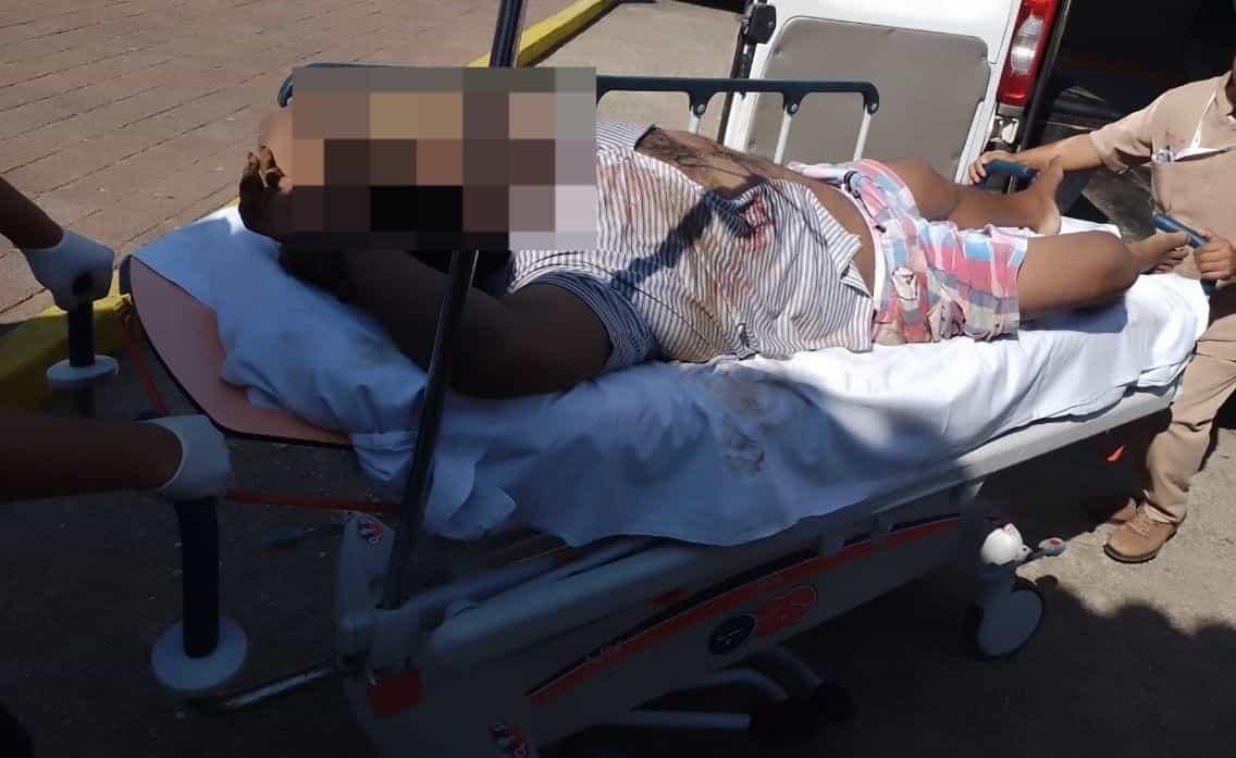 Atacan a balazos a hombre en calle de Ciudad Isla
