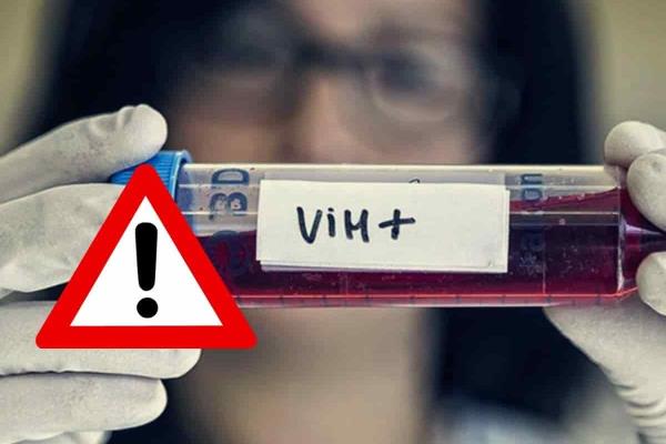 Exhorta IMSS a prevenir el SIDA y mantener una vida sexual responsable