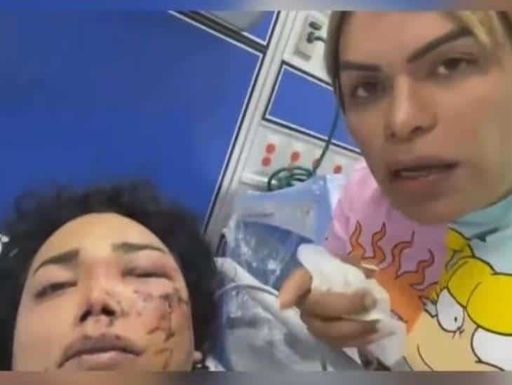 Paola Suárez de ‘Las perdidas’ reaparece en redes con severos golpes en el rostro