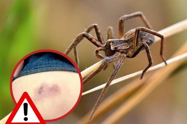 Araña violinista ¿Qué puedes hacer ante una picadura?