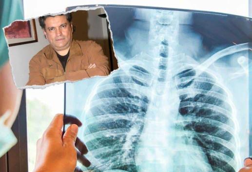 Sergio Andrade padecería EPOC, asegura enfermera tras ser hospitalizado